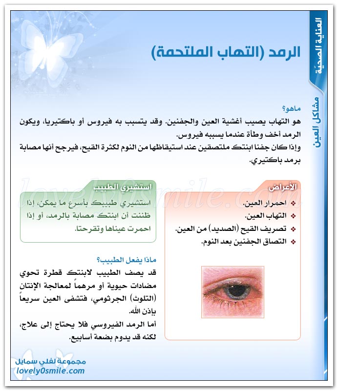 مشاكل العين + الرمد (التهاب الملتحمة)