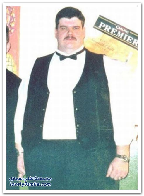 صور رجل بدين ينقص من وزنه 159 كلغم