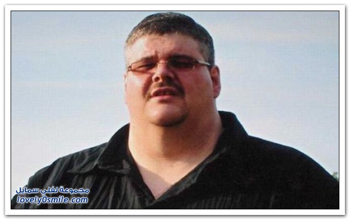 صور رجل بدين ينقص من وزنه 159 كلغم