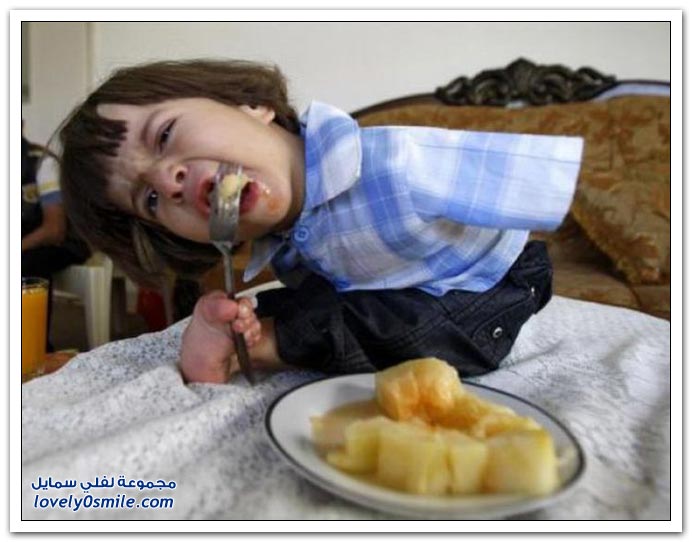 الولد الذي يستخدم رجليه بدل يديه