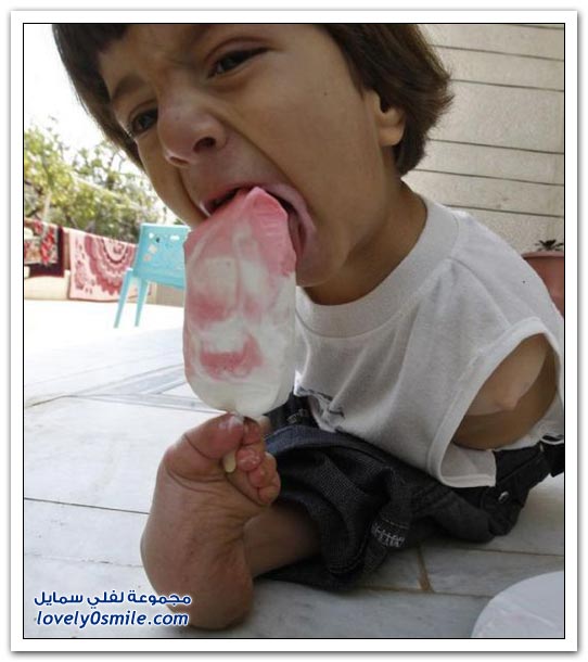 الولد الذي يستخدم رجليه بدل يديه