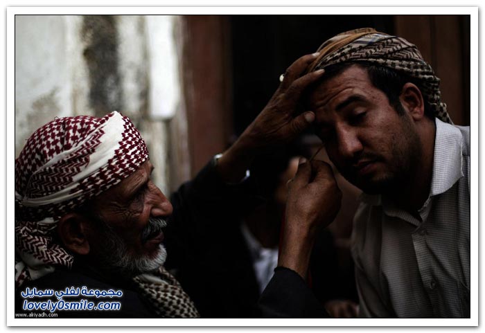 تكحيل العين في اليمن