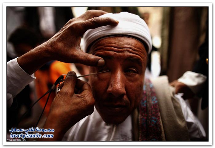 تكحيل العين في اليمن