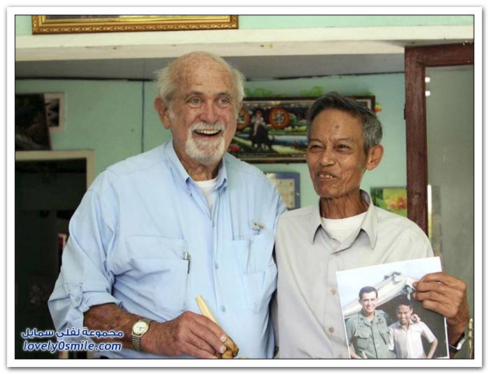 فيتنامي يستعيد ذراعه المبتورة بعد 47 عاماً