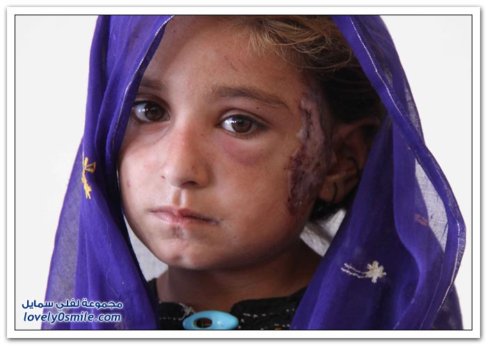 صور من الدمار الذي خلفه زلزال باكستان