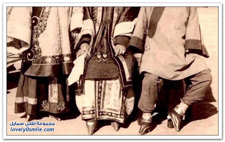 سر الأقدام الغريبة عند الصينيات