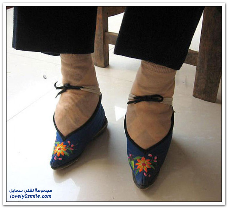 سر الأقدام الغريبة عند الصينيات