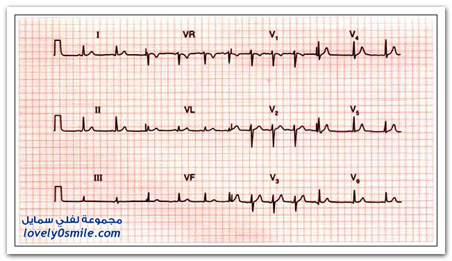 10 طرق يقاوم الناجحون بها ضغوط العمل