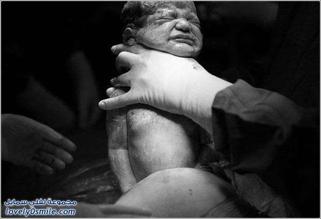 صور لطفل بعد الولادة مباشرة