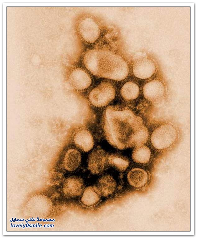 أول صورة لفيروس أنفلونزا الخنازير + سجان جوانتانامو